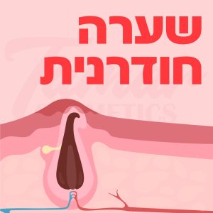 שערה חודרנית